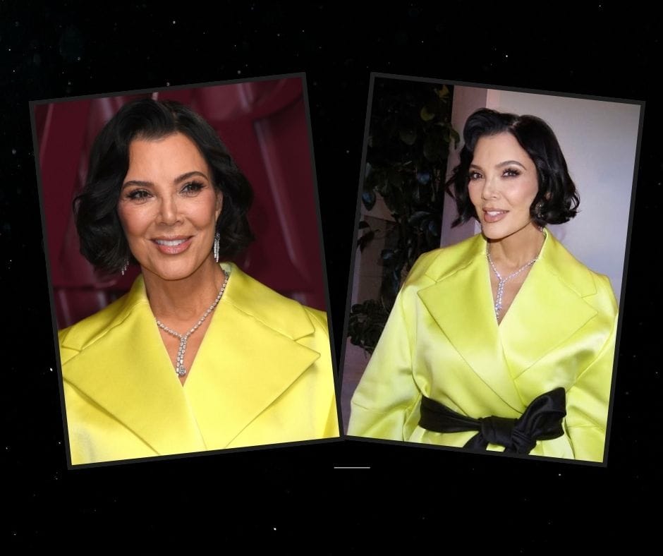 Κρις Τζένερ: Πως είναι το πρόσωπό της 69χρονης χωρίς φίλτρα μετά το facelift των 100.000 δολαρίων