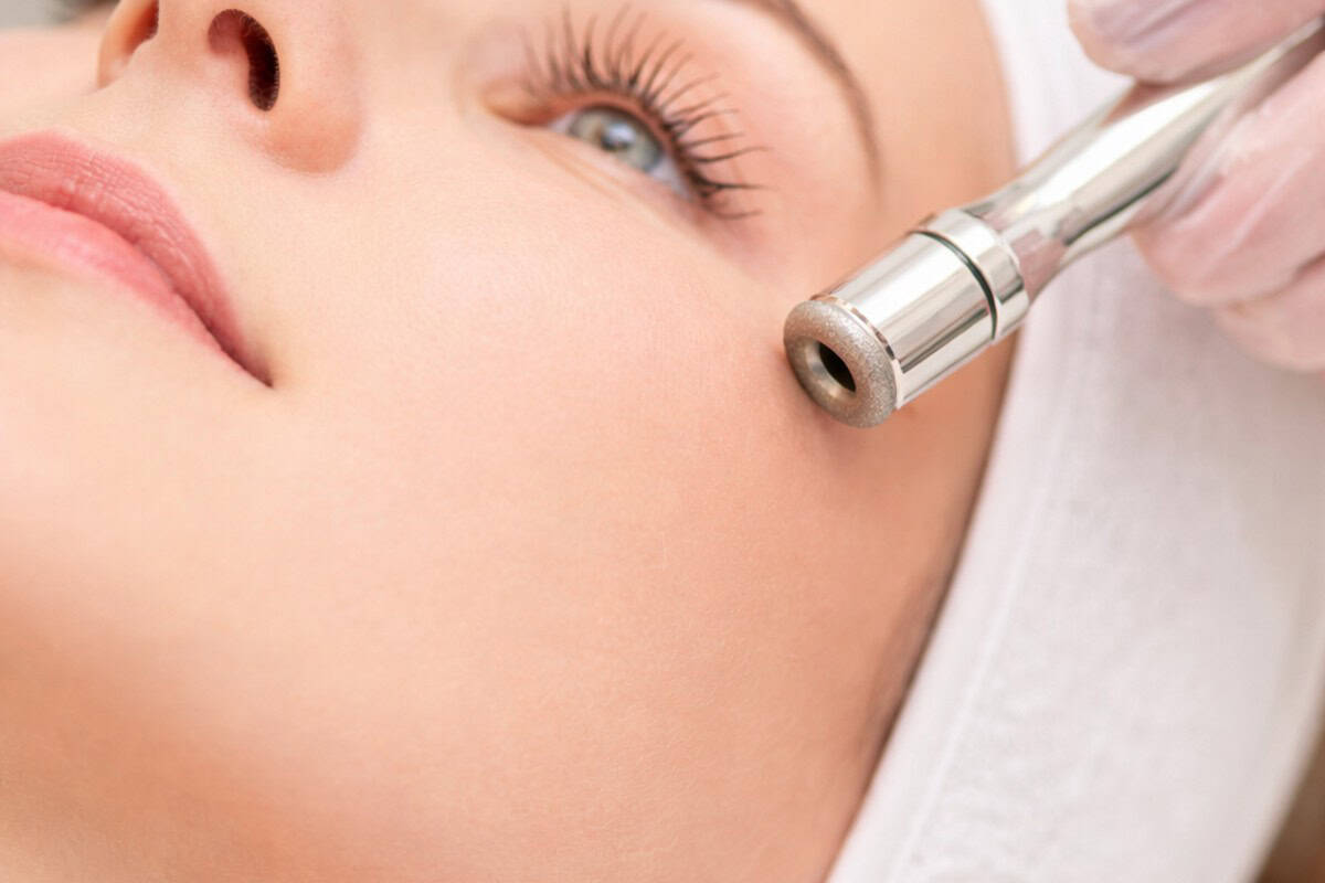 Δερμοαπόξεση με διαμάντι: Αξίζει; – Τι πρέπει να ξέρεις πριν κλείσεις το ραντεβού σου