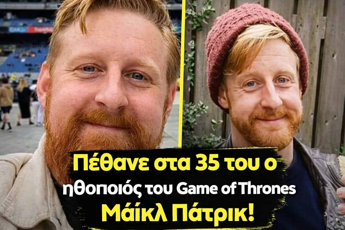 ΣΟΚ: Πέθανε ο 35χρονος ηθοποιός Μάικλ Πάτρικ του Game of Thrones – Η συγκλονιστική ανακοίνωση της συζύγου του