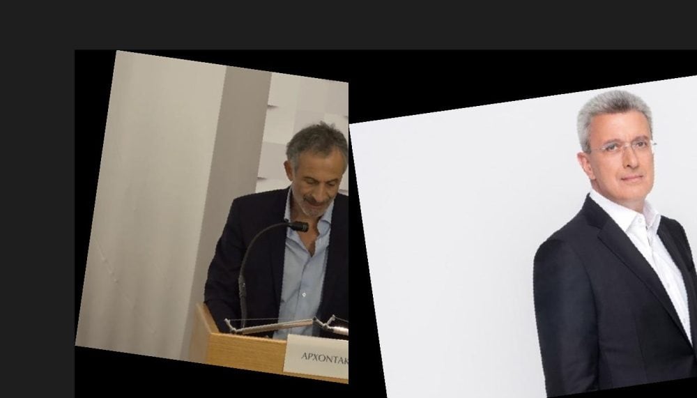 Νίκος Χατζηνικολάου: Συγκλονίζει για το ανεύρυσμα και το χειρουργείο 7 ωρών