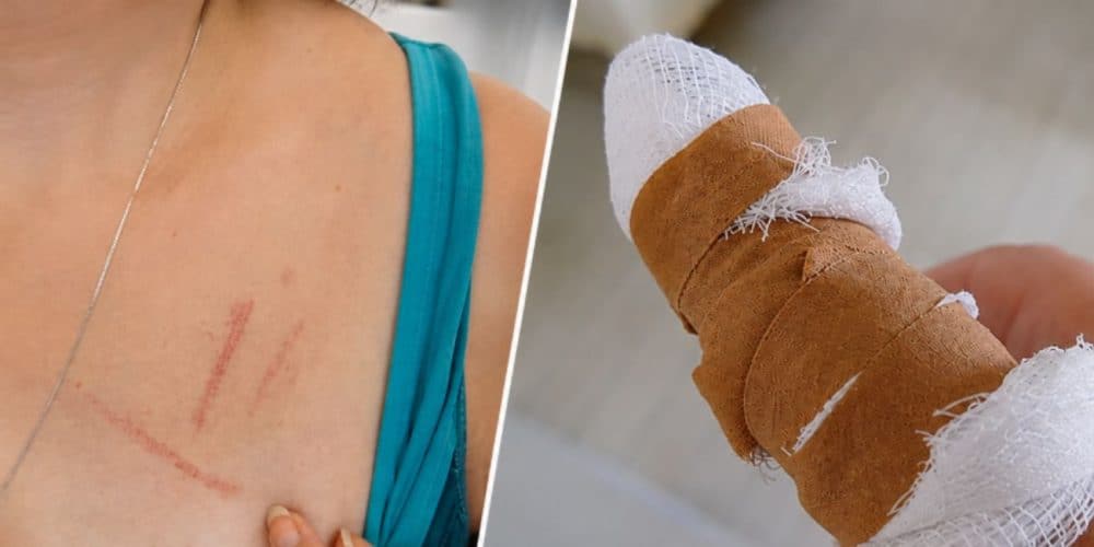 Σοκ! Γιατρός στο Βόλο έσπασε στο ξύλο συνοδό ασθενή! «Σηκώνεται επάνω, σπρώχνει την ηλικιωμένη μητέρα μου, με πιάνει από το λαιμό και με χτυπούσε με μανία” (video)